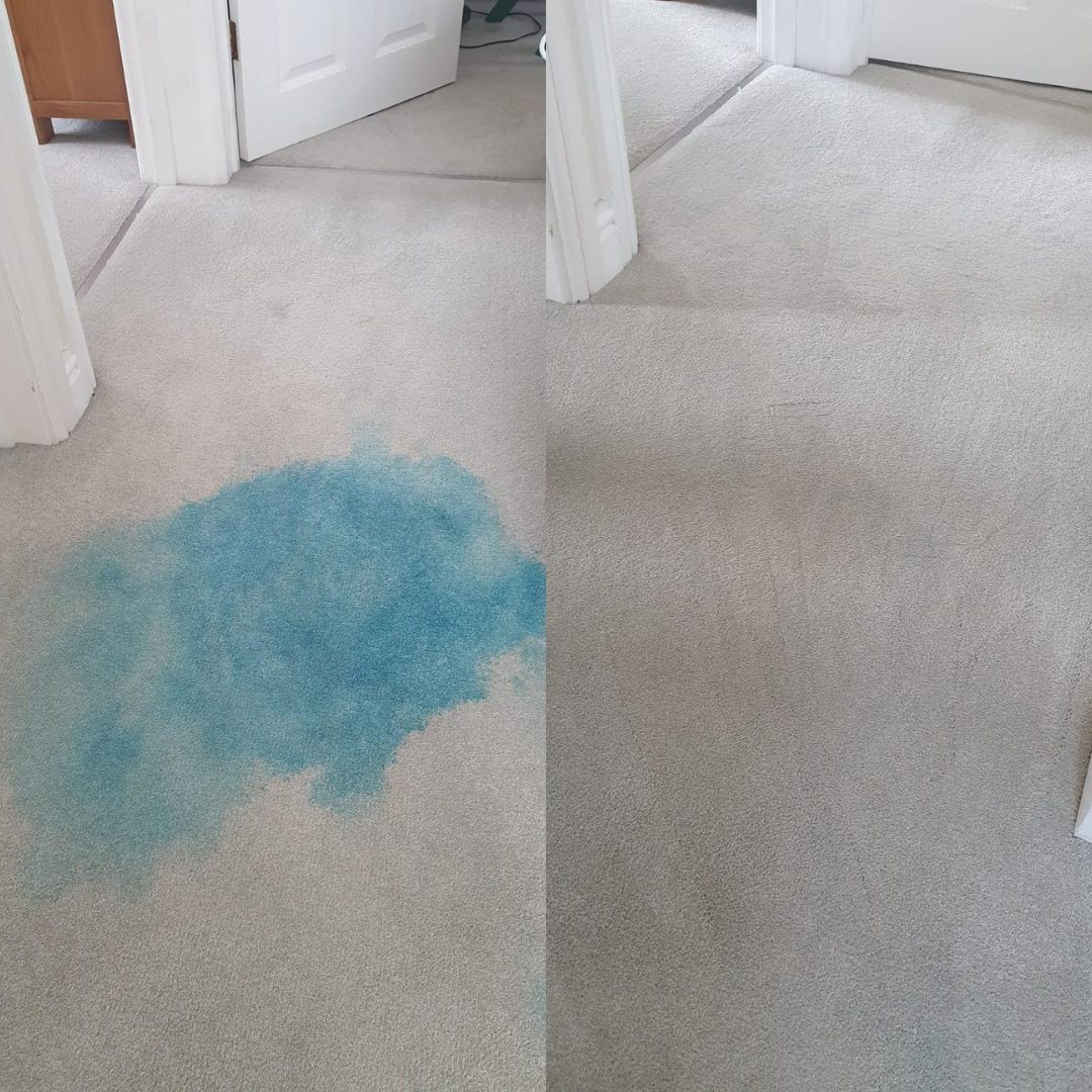 Blue dye stain — completely removed